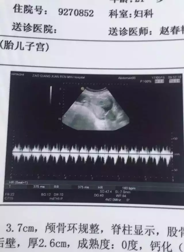 懷男孩有哪些特徵初期：懷男孩有什麼特徵和感覺
