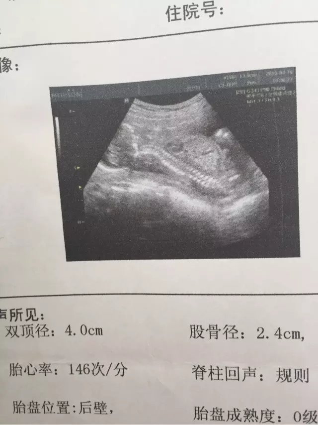 一個男孩,兩個男孩,三個男孩都是什麼銀行?另外一個女孩兩個女孩三個女孩呢？