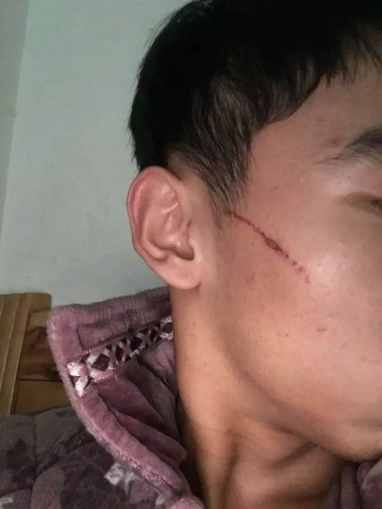 3、男人出軌抓痕一般在哪:男人身上有抓痕是出軌了嗎？