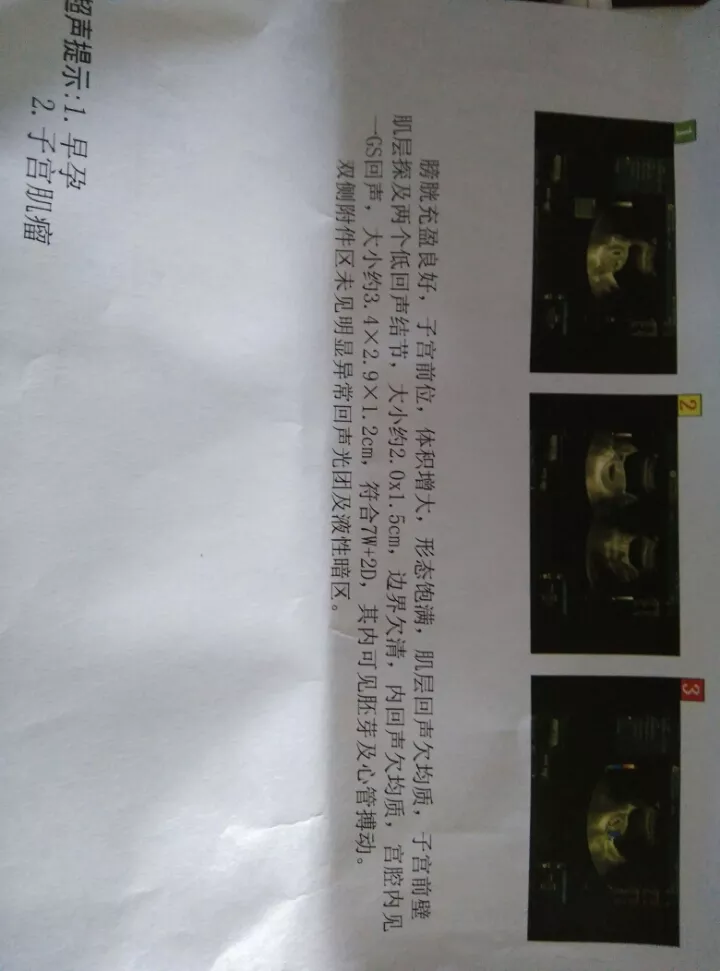 懷孕50天懷男孩表現：喜脈怎麼判斷是男女