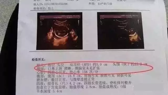 已生男孩的線圖片：生男生女肚型有什麼不同