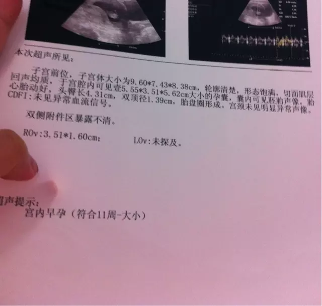 孕囊的三個數據看男女准嗎：孕囊什麼時候看形狀最准
