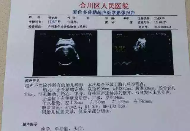 懷孕初期懷寶有什麼特徵：懷男孩有什麼反應