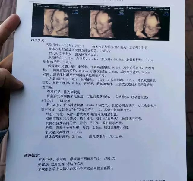 懷孕最快測出男孩女孩：怎麼能最快知道懷的男孩女孩