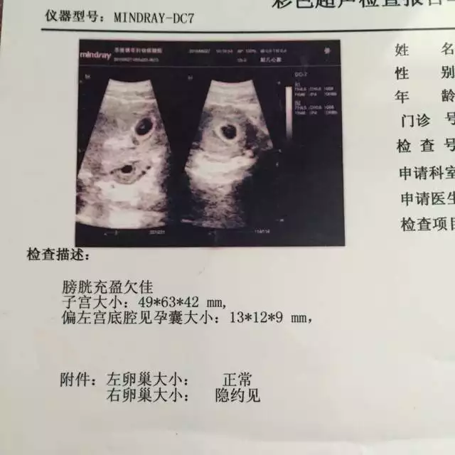 5、成功一個月備孕男孩:怎樣備孕調理身體生男孩子？