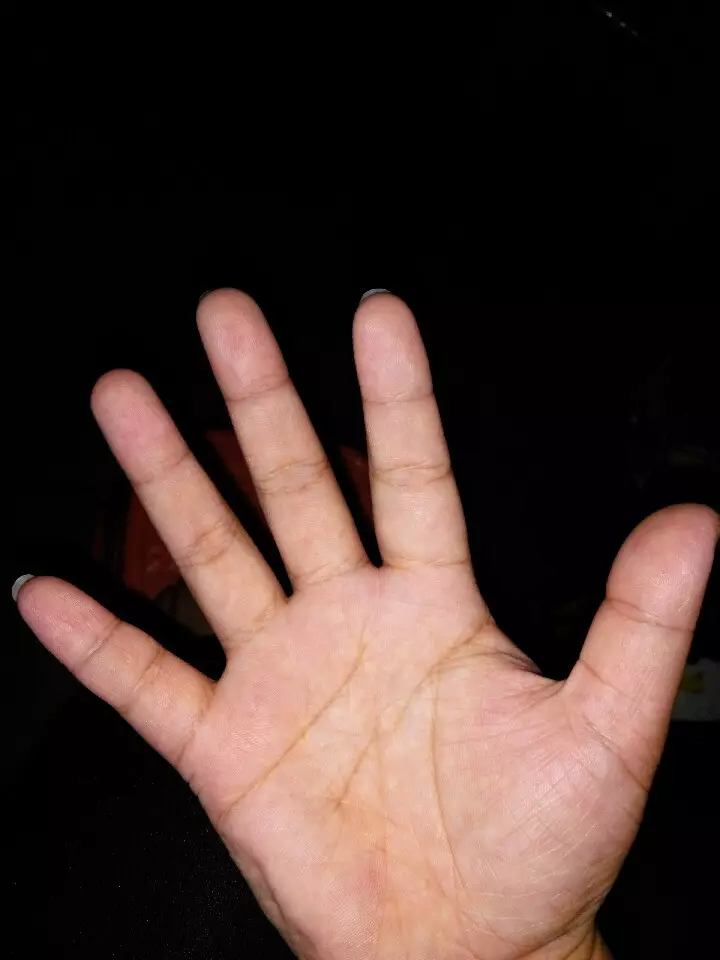 我的手掌一左一右，我的手線怎麼那麼亂，什麼意思呢？我有幾個孩子的命呢？性別女，年齡25
