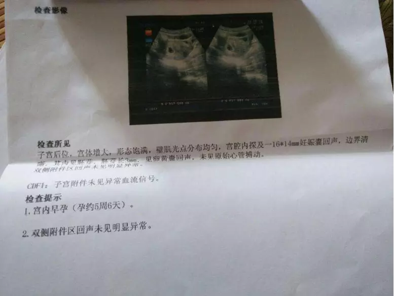 懷兒子雙頂徑一般都會大嗎：看三維怎麼分辨男孩女孩