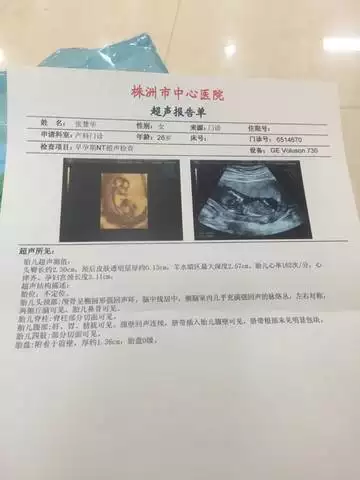 懷孕90天看男女準確率：我12周做了b超是女孩能相信么
