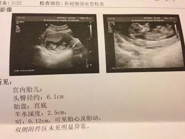 3、個人備孕經驗已成功:生男孩經驗有哪些？