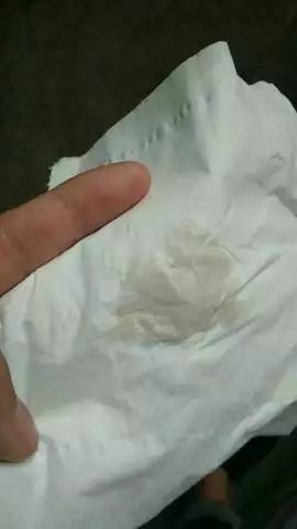 懷孕初期癥狀是什麼顏色：早孕初期，晨尿顏色是不是會加深，比較黃