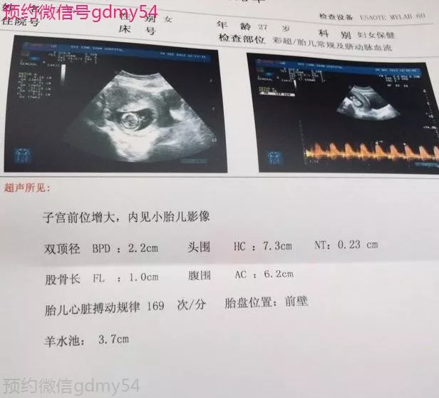 1、為什麼總懷女孩懷不上男孩:為什麼懷的都是女孩,是不是男的有問題啊