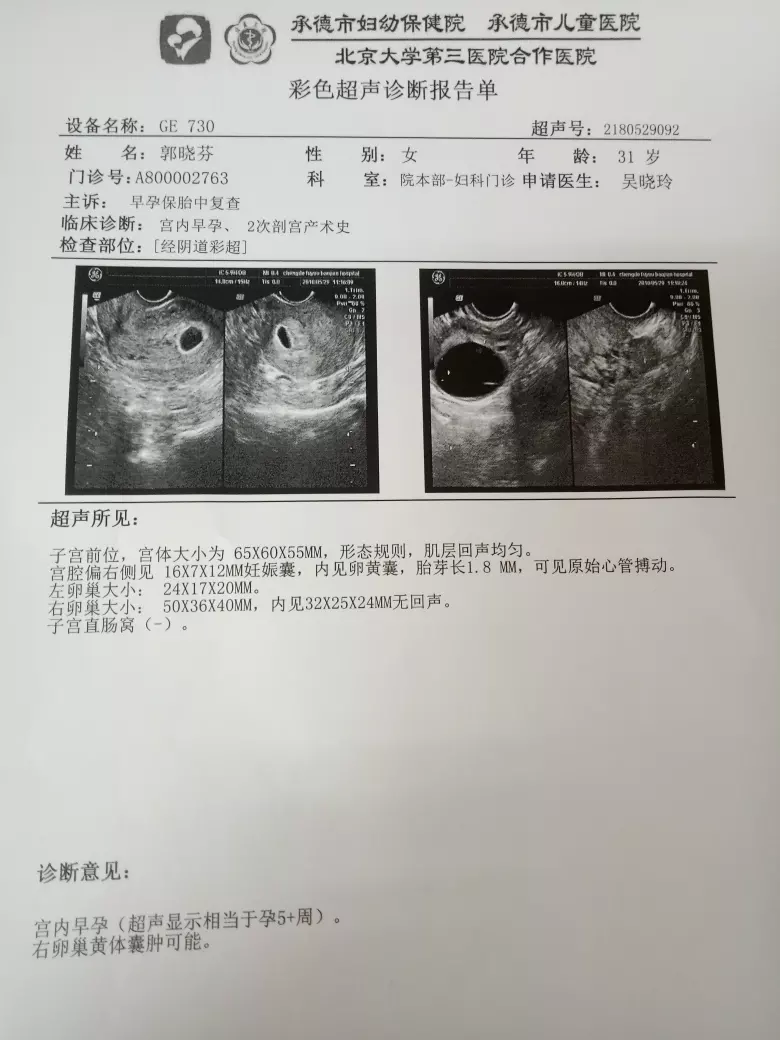 早孕看孕囊看男女准嗎：孕囊什麼時候看形狀最准