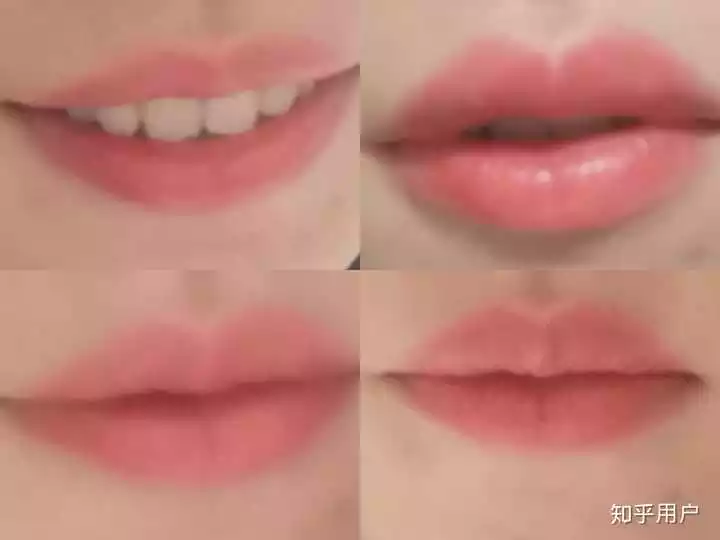3、上嘴唇又厚又翹怎麼辦:嘴唇稍微有點厚，而且上嘴唇，好看嗎？女生