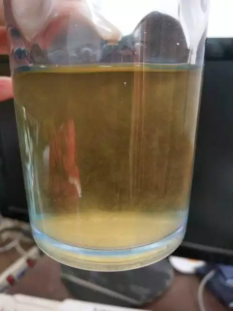 用酒精怎樣檢查男孩女孩：用酒精兌晨尿測男女准嗎