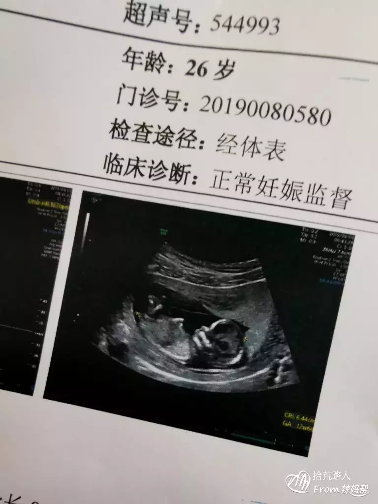 怎麼知道男孩女孩懷孕：怎樣知道我懷的是男孩還是女孩?