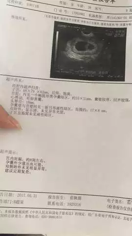 懷孕一個月看不到孕囊正常嗎：懷孕不到一個月能看到孕囊嗎？