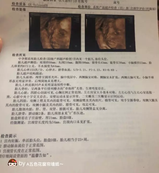 單歲雙月下半月是男孩女孩：十男九漏有科學依據嗎？