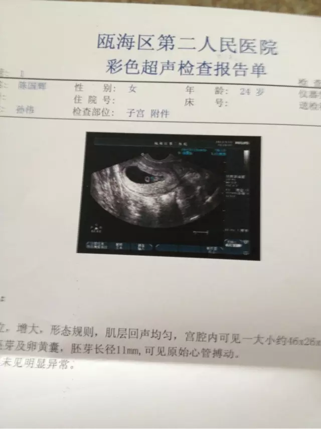 懷孕幾個月能看出男女孩兒B超：懷孕幾個月可以分辨胎兒性別
