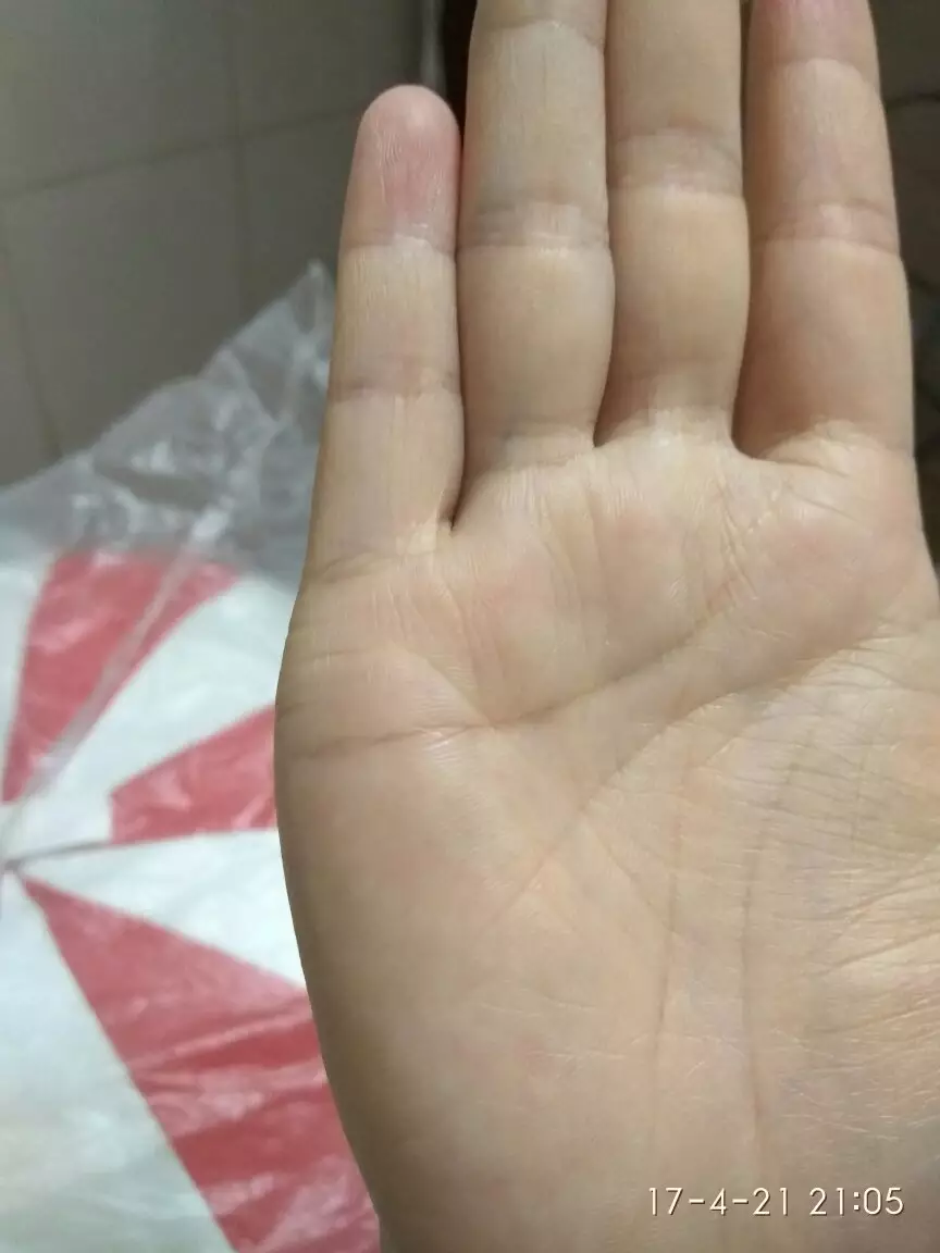 4、婚姻線:婚姻線什麼意思