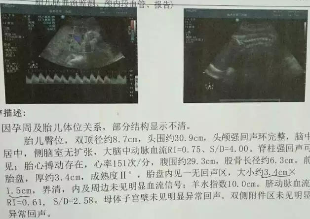 3、懷兒子最明顯的徵兆:懷男孩的預兆
