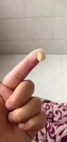 懷孕黃黃的生男孩：懷孕后物多發黃是男是女