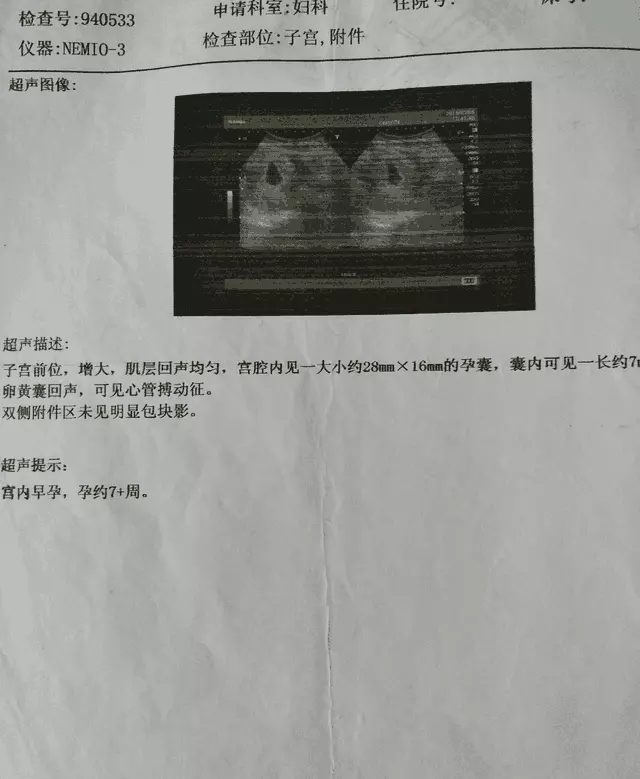 懷女孩的早期癥狀最準的：懷上女孩的癥狀要怎麼判斷呢？