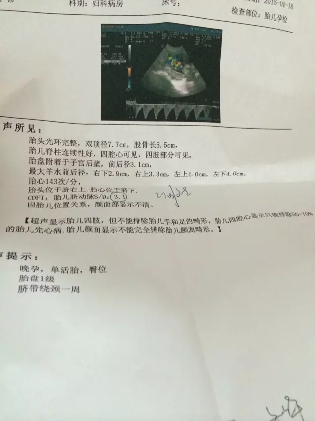 4、雙頂徑和股骨長判斷生男生女:從B超單上怎麼看看雙頂徑股骨長看生男生女