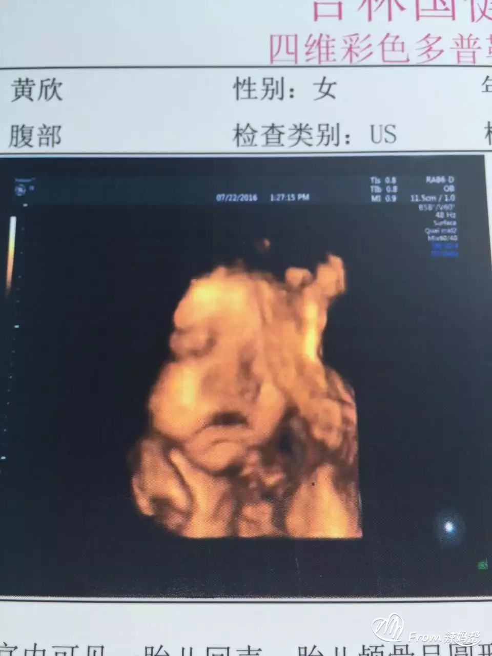 1、有人說生男生女可以看男人看得出來，你們幫我看看我男友的是生兒子多還是女兒多？