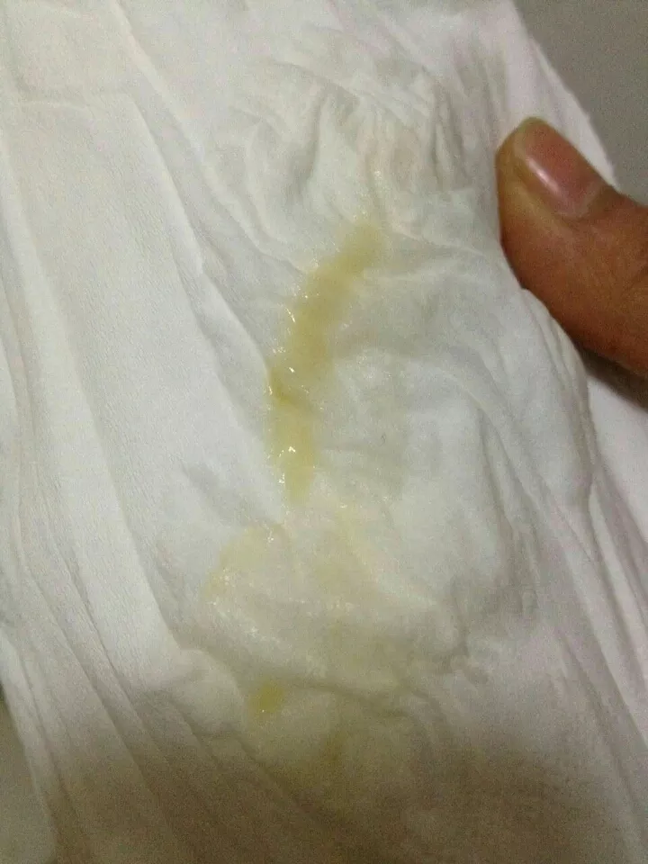 懷孕人的尿是什麼顏色：懷孕后的是什麼顏色
