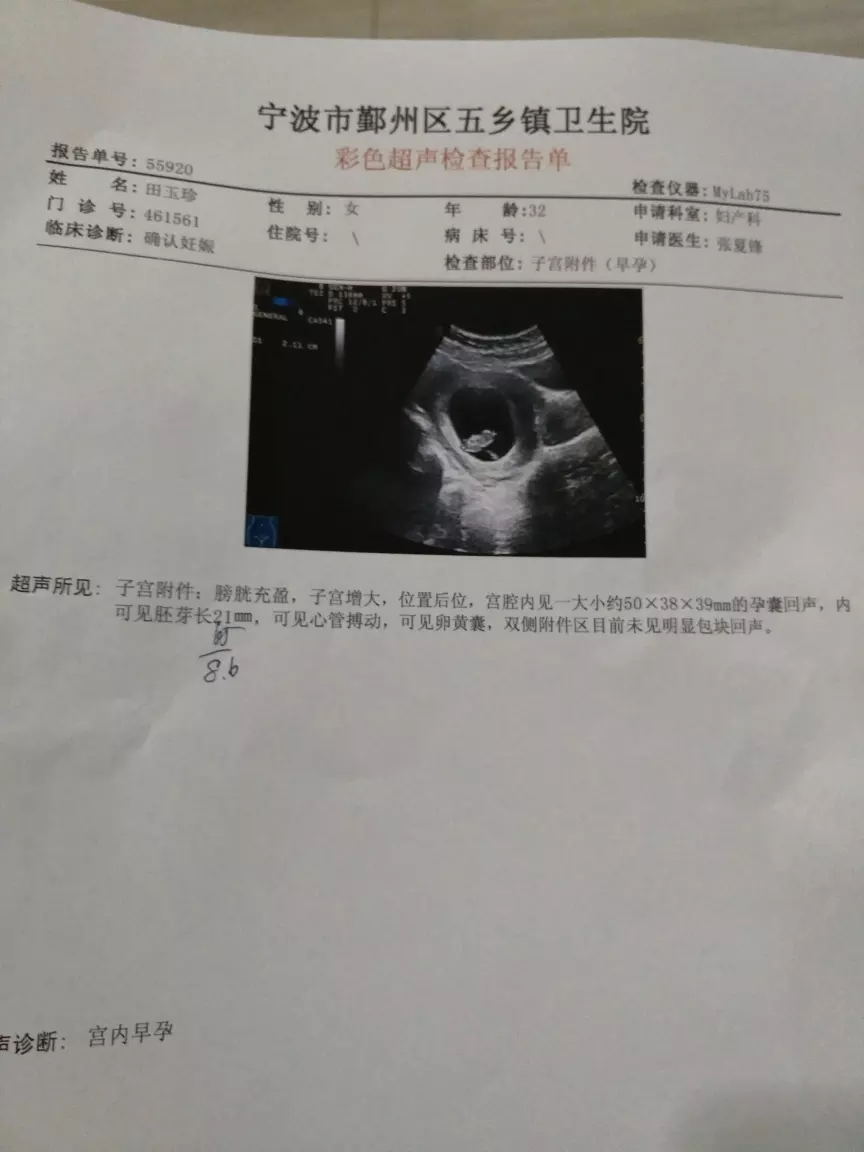 懷孕兩個月怎麼分辨出來男孩女孩：懷兒子和女兒的區別