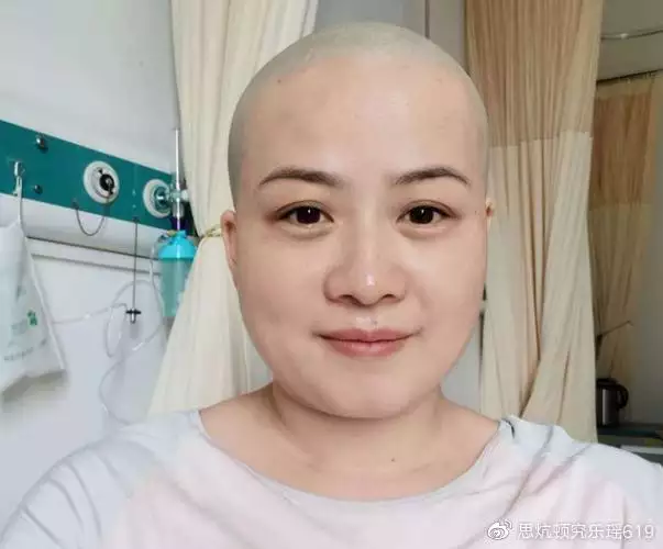 1、婚配節目的誰人禿頂叫什麼:電視台禿頂的誰人叫什麼