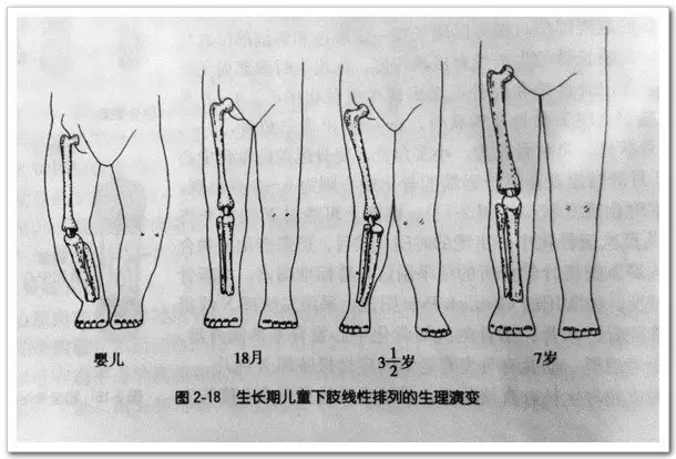 4、[單選題]正常女性與患佝僂病的男性婚配,他們的子女中只有女兒患病,患病女