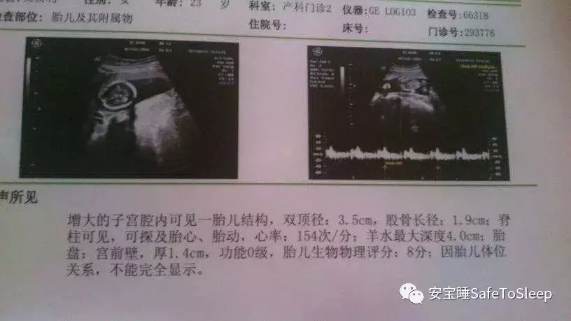 1、聽說有一個表格，可以根據孕婦的年齡和懷孕月份測算男女，是真的嗎？