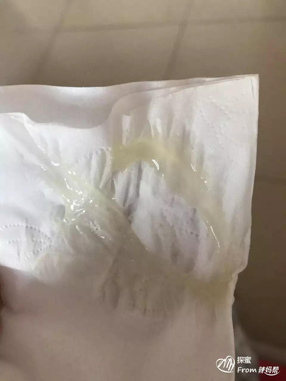 懷女寶物多還是物多：24周的在孕婦肚子里趴着睡怎麼回事
