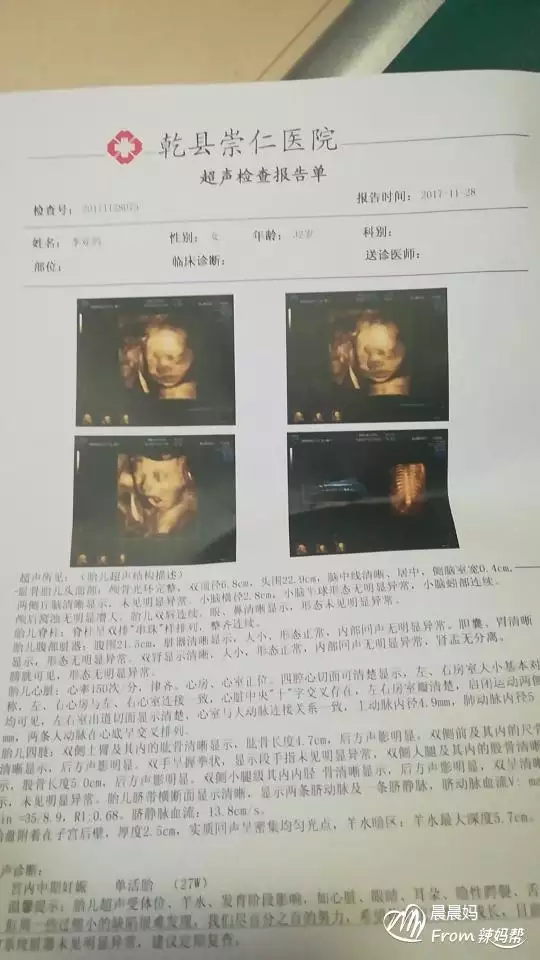 的四維彩超單子真實：請問在這個四維彩超單上可以看出寶還是女寶寶嗎