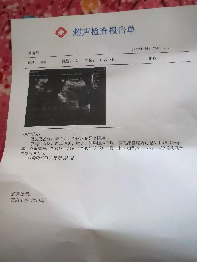 從第一胎小孩頭的形狀可以看出第二胎生男生女嗎