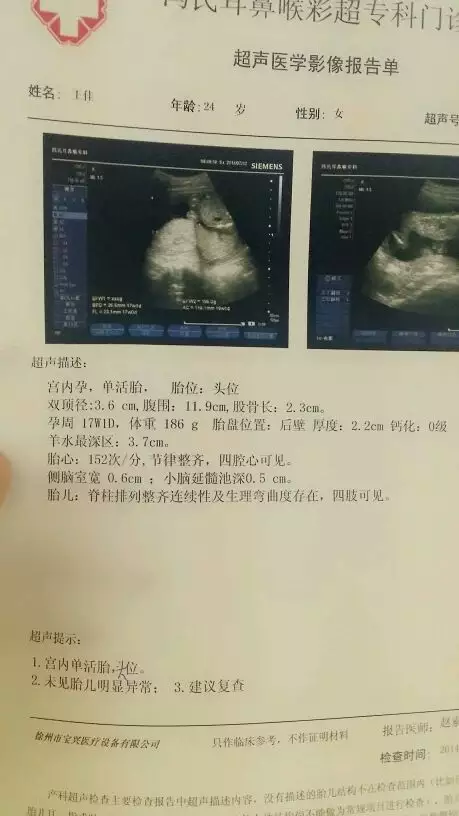 天查男孩女孩準確率高嗎：天查出是男孩，會看錯嗎？
