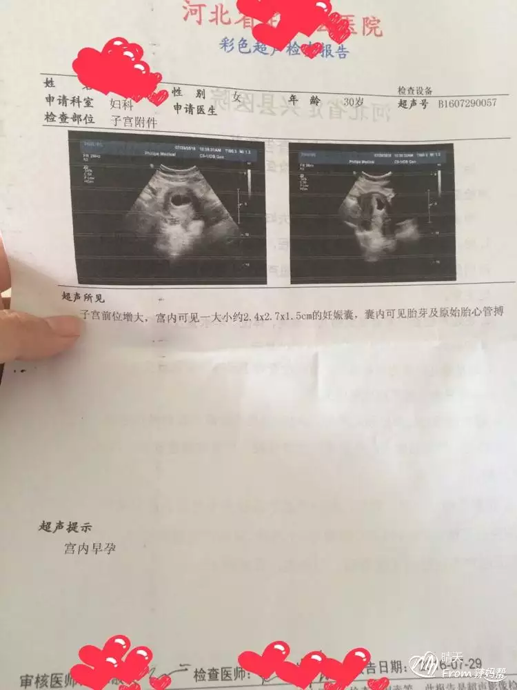 6、怎麼懷男孩的幾率大:怎麼樣懷男孩的幾率高？平時需要注意什麼？