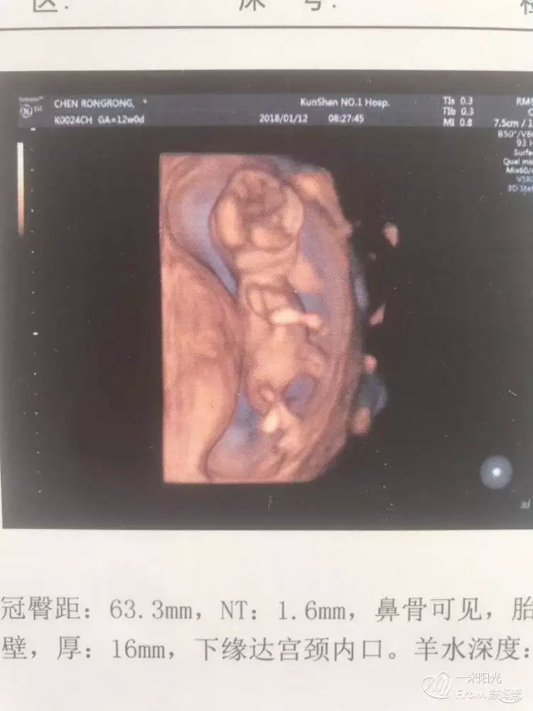 1、怎麼懷男孩的幾率大:怎麼可以生男孩幾率大