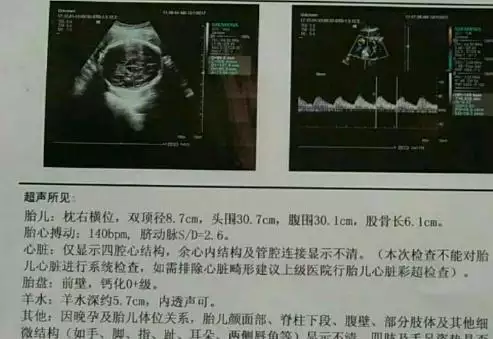 二胎懷孕的徵兆有哪些：二胎 早孕反應，二胎早孕反應的癥狀有哪些