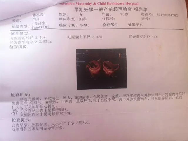 孕囊大小和性別有關嗎：看孕囊數據大小能看出男女嗎