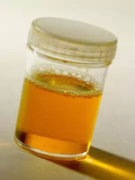 顏色能看出懷孕嗎：早孕初期，晨尿顏色是不是會加深，比較黃