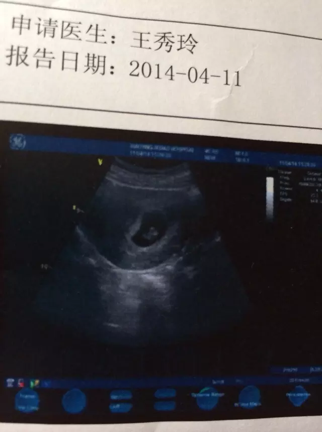 算有幾個孩子男孩女孩准嗎：算男女，大家算算準不準