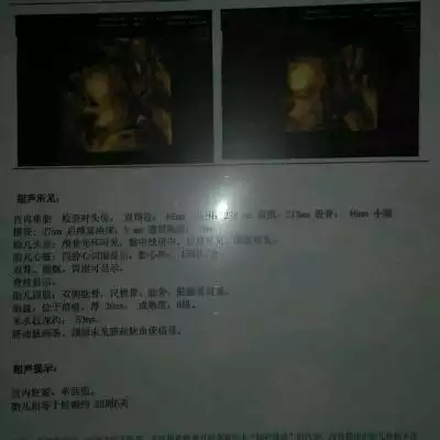 3、輸入懷孕月份算男女:生男生女口訣怎麼算
