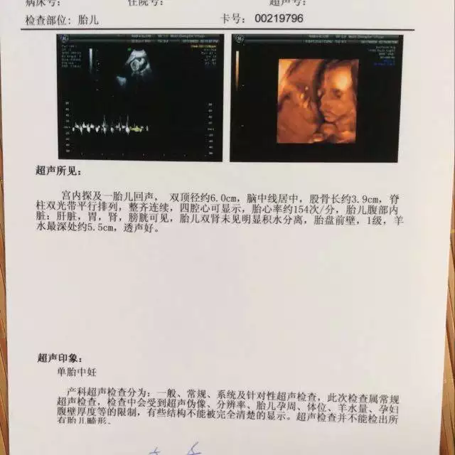 懷孕幾個月能看出男女最清楚：四個月看男孩女孩準確嗎