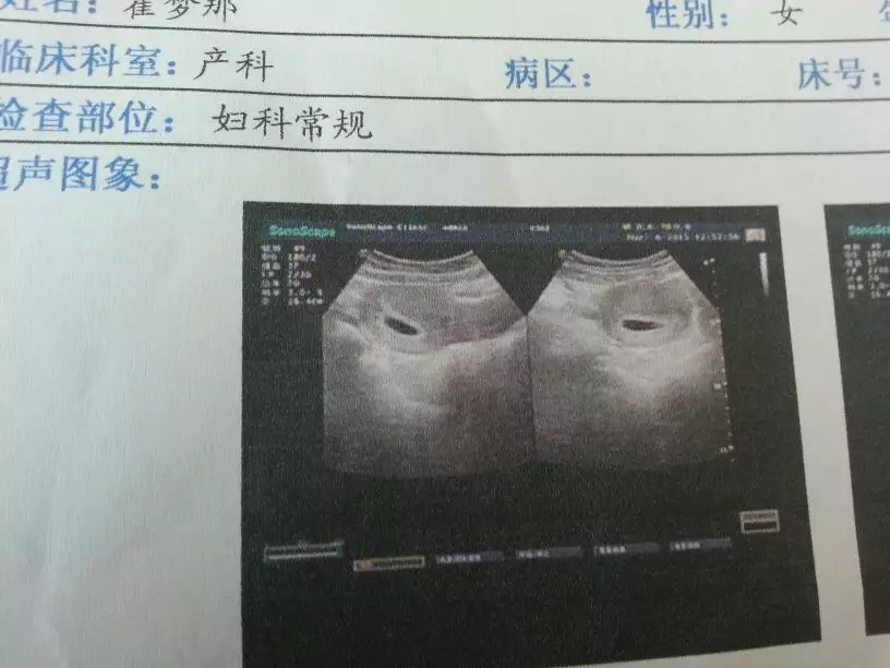懷孕初期生男生女癥狀：懷男孩有什麼特徵和感覺