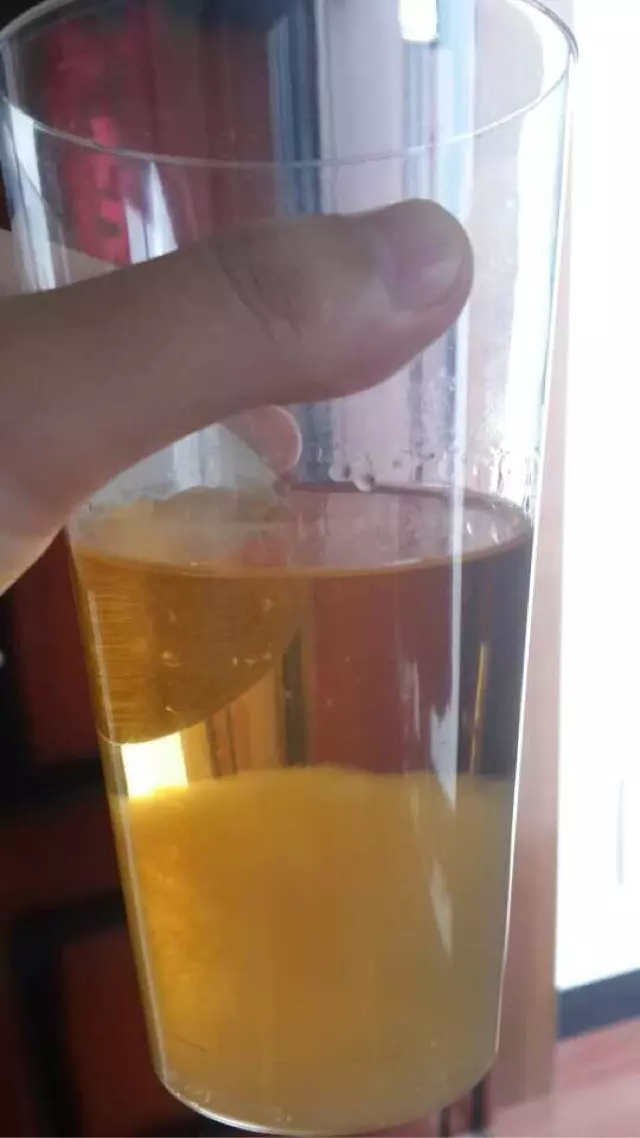 用酒精測試懷男女的方法：酒精測男女