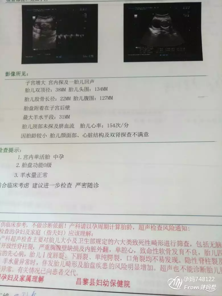5、輸入懷孕月份算男女:生男生女最準確的口訣