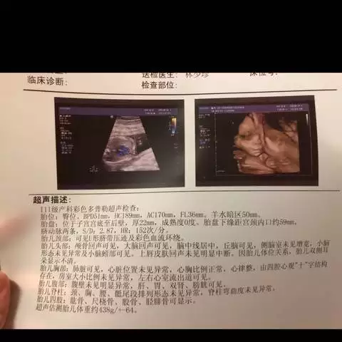 3、什麼時候懷女孩幾率:怎樣懷女孩的幾率？生女孩的科學方法是什麼呢？