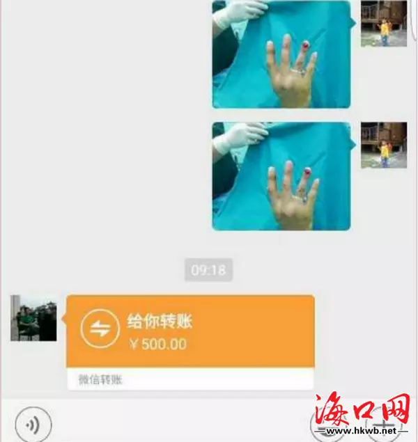 紅包怎麼能發元：微信紅包怎麼發金額